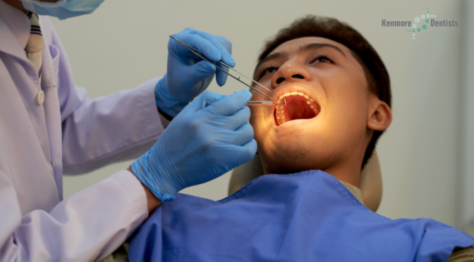 Effective Solutions for Chipped Tooth Repair in Kids – A Sneak Peek